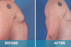 before-and-after-shot